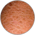 Patches of skin that appear rough or leathery