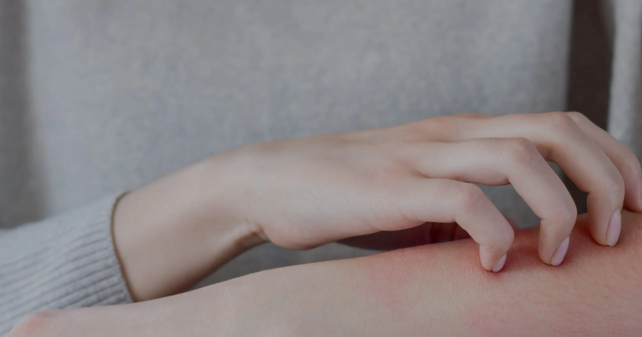 Eczema Banner Mobile