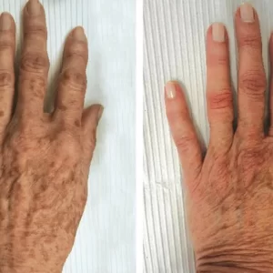 a close up of a persons hand