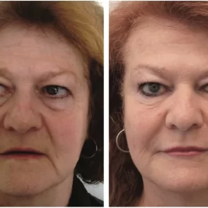 a close up of a man and woman posing for a photo