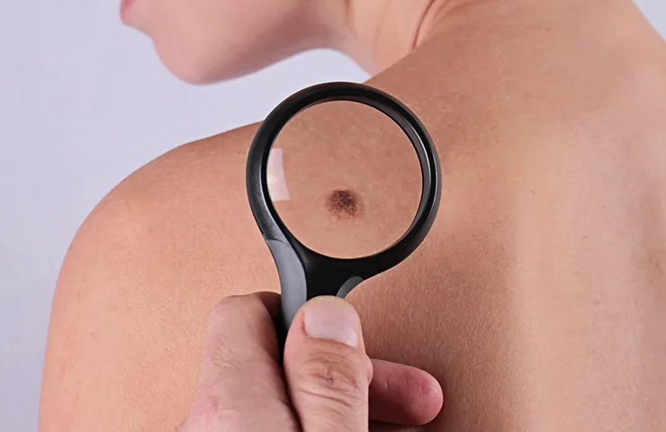 Premier Dermatology Surigcal Services